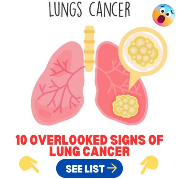 10 Overlooked Signs of Lung Cancer You Shouldn't Ignore